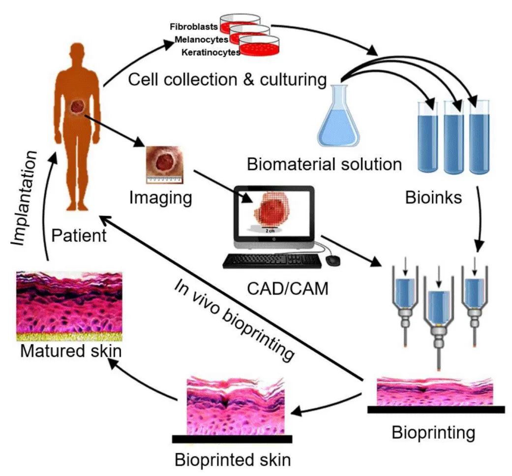 3D Bioprinting in Medicine