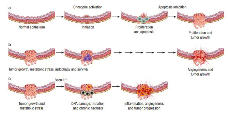 Autophagy and the potential linkage with the human oral diseases