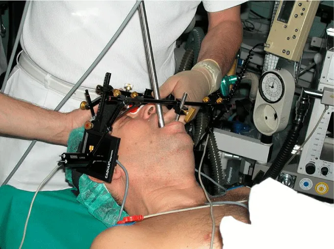 Temporomandibular Joint Movements during Rigid Bronchoscopy and